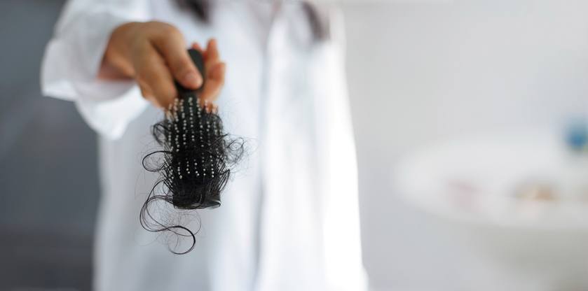 Tratamento para queda de cabelo exige uma investigação detalhada sobre as causas – iStock/Getty Images