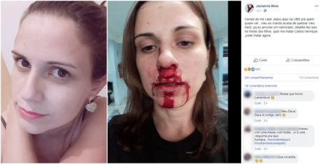 Jackeline Mota teve o nariz quebrado pelo ex, após crise de ciúmes do mesmo