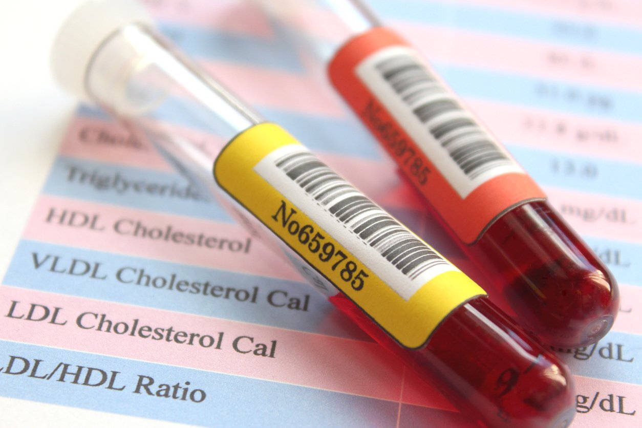 Exames de colesterol total precisam ser feitos regularmente