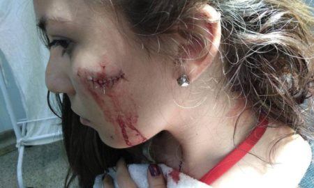 Letícia Copaja teve ferimentos no rosto e na cabeça