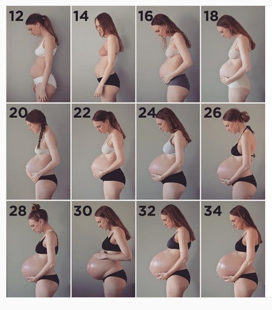 Montagem mostra avanço da gravidez de trigêmeos