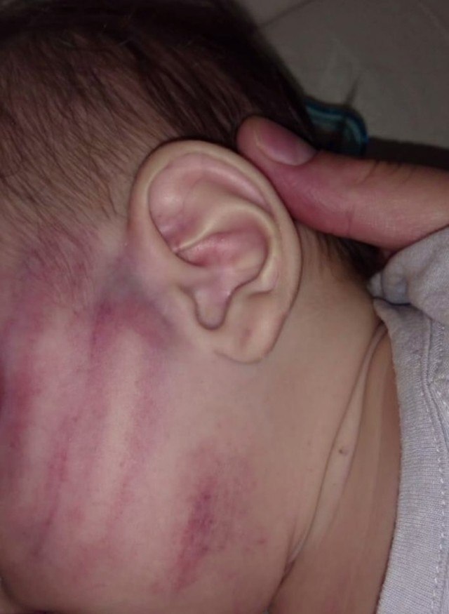 Bebê de 5 meses é agredido pelo próprio pai, e homem diz que bateu “sem intenção de machucar”
