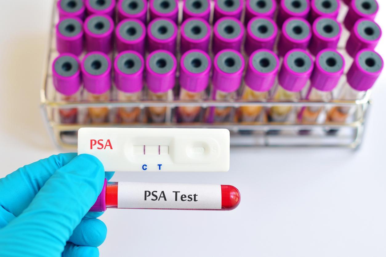Exame de PSA ajuda a detectar câncer de próstata e outras doenças