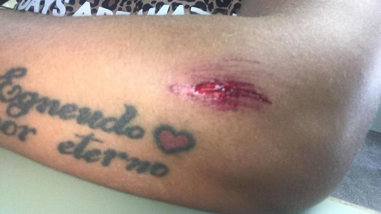 Tatyana feriu o braço ao tentar se defender das agressões