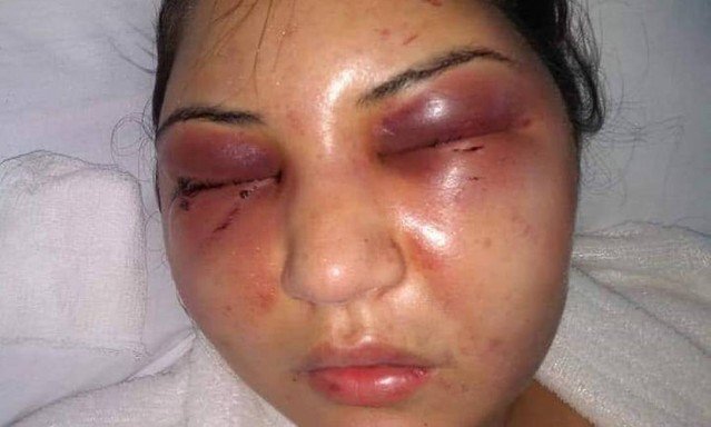 Parentes divulgaram fotos do rosto de Christini após a agressão