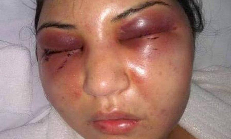 Fotos do rosto de Christini após a agressão do marido foram publicadas por parentes nas redes sociais.