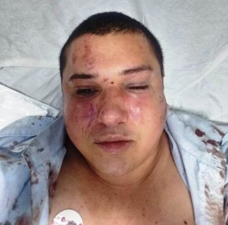 Motorista Anderson Brito depois de ser espancado por assediar uma garota