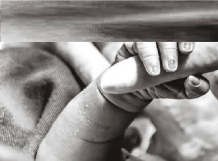 Bebê coloca a mão para fora por meio da abertura para iniciar sua cesariana
