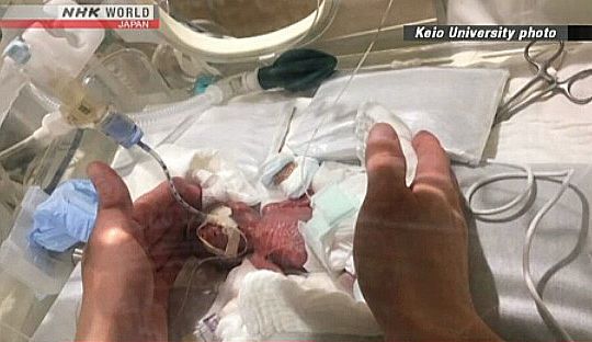 Bebê passou 5 meses na UTI neonatal