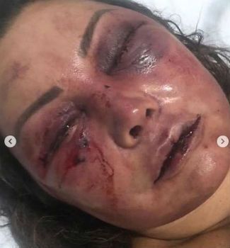 Elaine Perez Caparroz, de 55 anos, foi agredida por Vinícius Batista Serra, de 27 anos