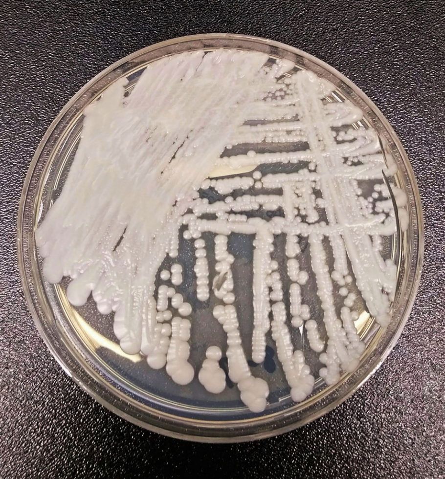 fungus in laboratory