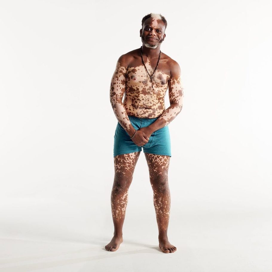 Bashir Aziz, que tem vitiligo, é um dos integrantes de um projeto que luta contra a estereotipagem dos homens na mídia