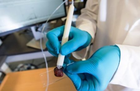 Usado em cirurgias, aparelho indica onde estão as células cancerígenas, que podem ser retiradas com mais precisão