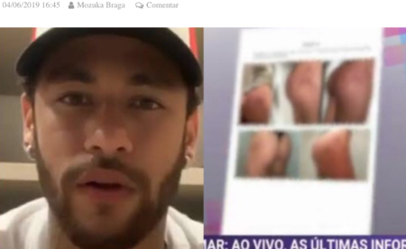 Imagens dos hematomas na mulher que acusa Neymar de estupro