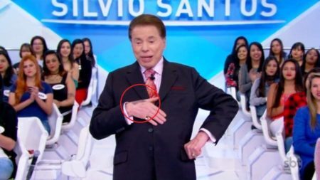 Silvio Santos explica mancha nas mãos