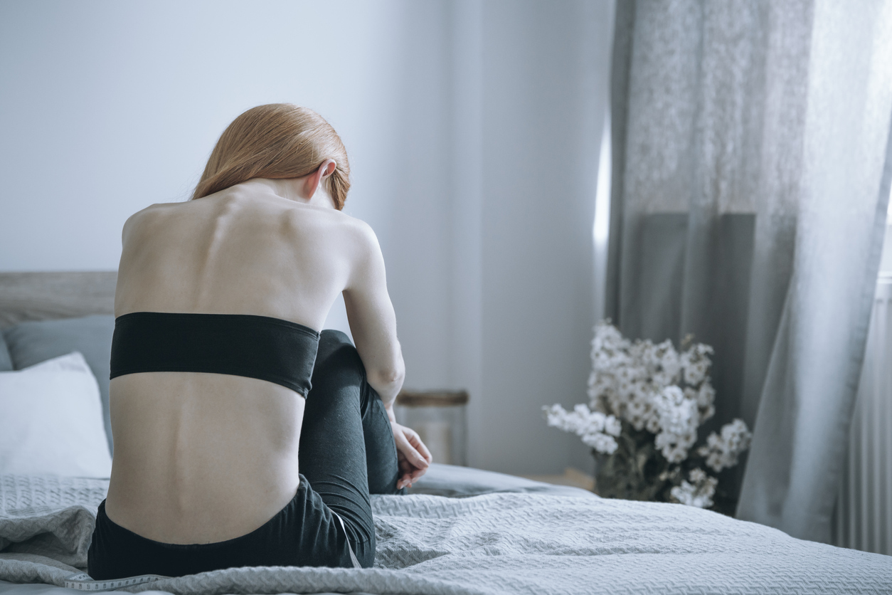 Os sintomas da anorexia se manifestam não só no corpo, mas também na mente e nas emoções. Entenda as causas – iStock/Getty Images
