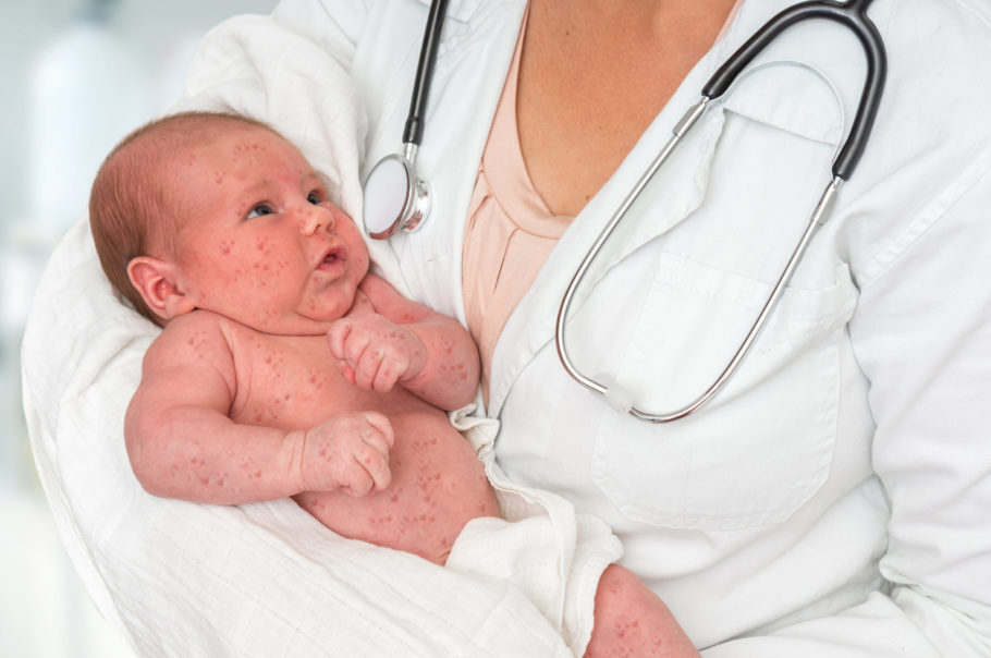 Bebês sofrem com maior potencial de contágio