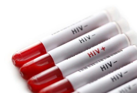 amostras de sangue para teste de hiv