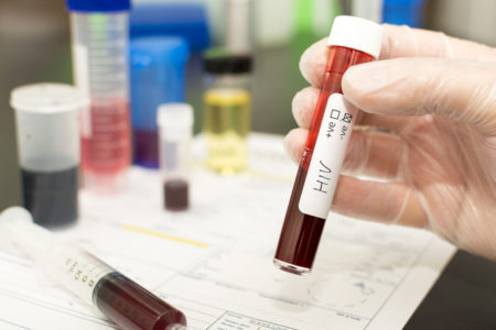 mão segurando um tube de amostra de sangue de teste de hiv