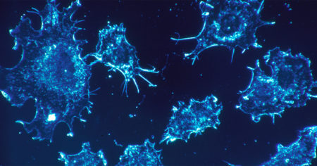 Técnica usa células modificadas para combater as cancerosas