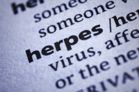Causada pelo vírus da herpes simples, a doença pode afetar tanto homens como mulheres