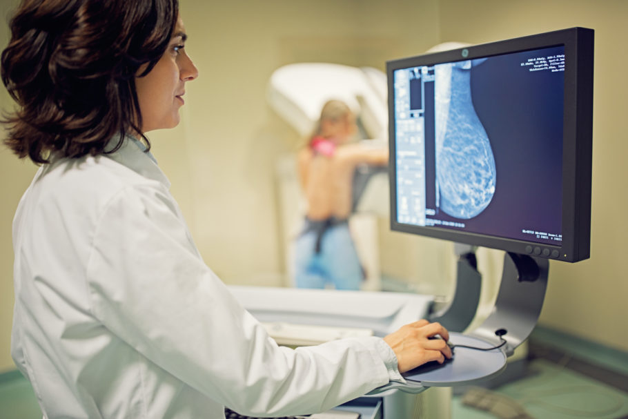 Todas as mulheres acima dos 40 anos devem realizar mamografia