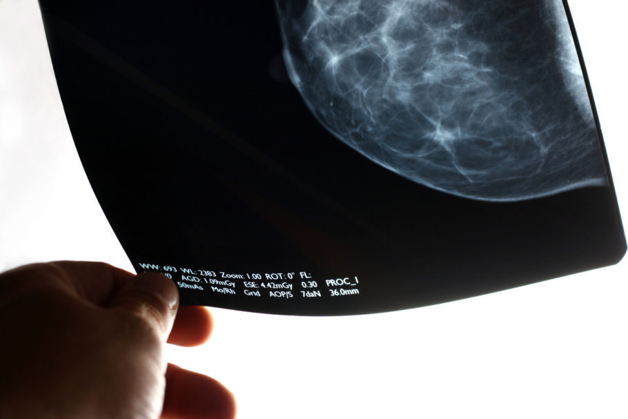 Carreta vai oferecer cerca de 60 mamografias por dia
