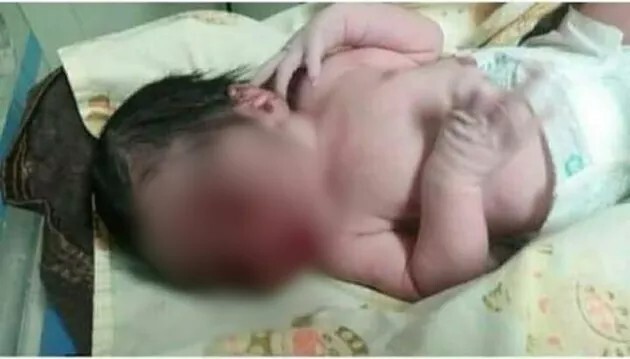  Bebê foi retirado do hospital de Taguatinga (DF) horas após de nascer