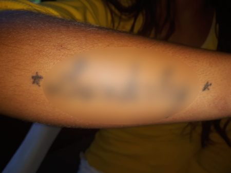 Menina estuprada foi obrigada a tatuar nome do estuprador