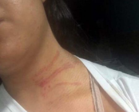 Mulher no Rio de Janeiro sofre violência doméstica