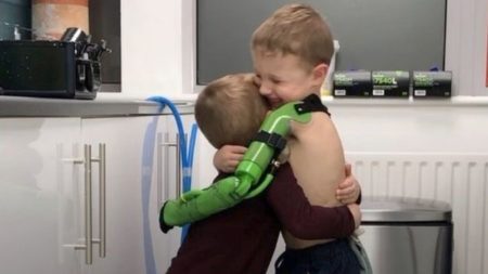 Menino abraça irmão pela primeira vez após ganhar próstese de braço