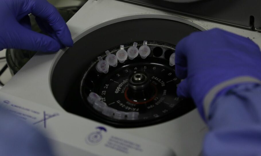 Diagnóstico laboratorial de casos suspeitos do novo coronavírus (Covid-19), no Instituto Oswaldo Cruz (IOC/Fiocruz),