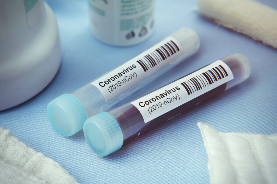 Governo vai distribuir 30 mil testes específicos para o novo coronavírus