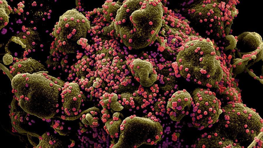 O novo coronavírus (em rosa) infectam células humanas, que replicam material genético e morrem