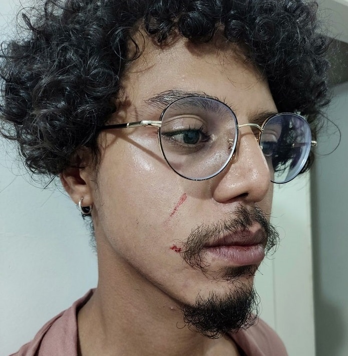 Renan Rodrigues foi agredido dentro de supermercado em Florianópolis