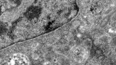Imagens da Fiocruz mostram ataque do coronavírus às células do corpo