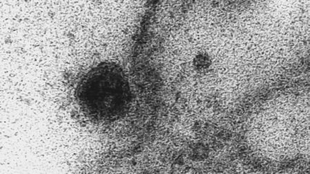 Imagens da Fiocruz mostram ataque do coronavírus às células do corpo
