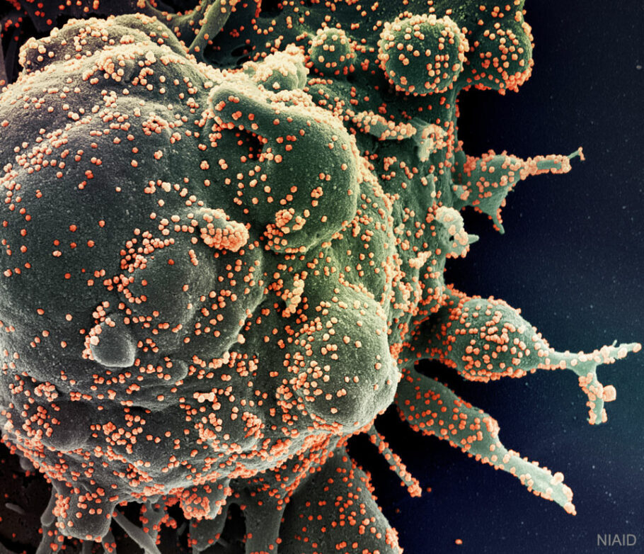Imagem ampliada mostra o coronavírus atacando uma célula humana