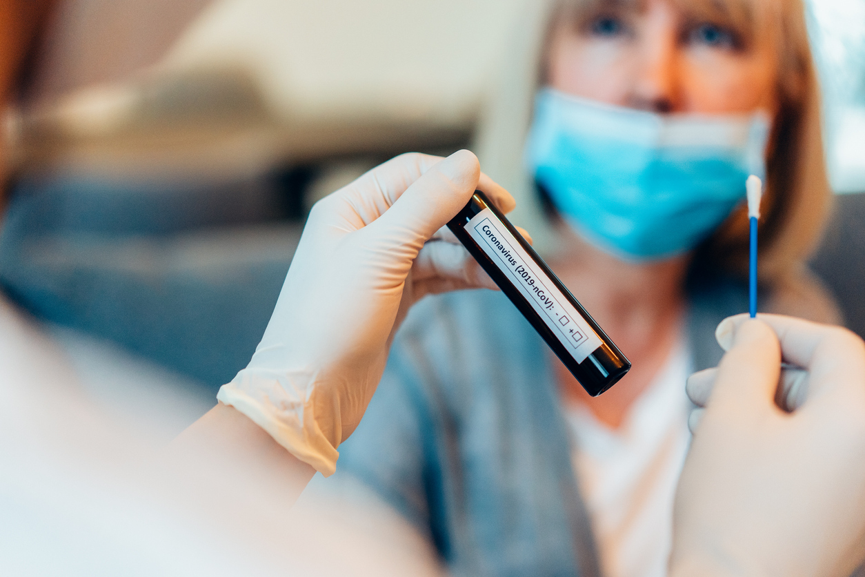 Um em cada três testes RTPCR feitos em SP dá positivo para covid19