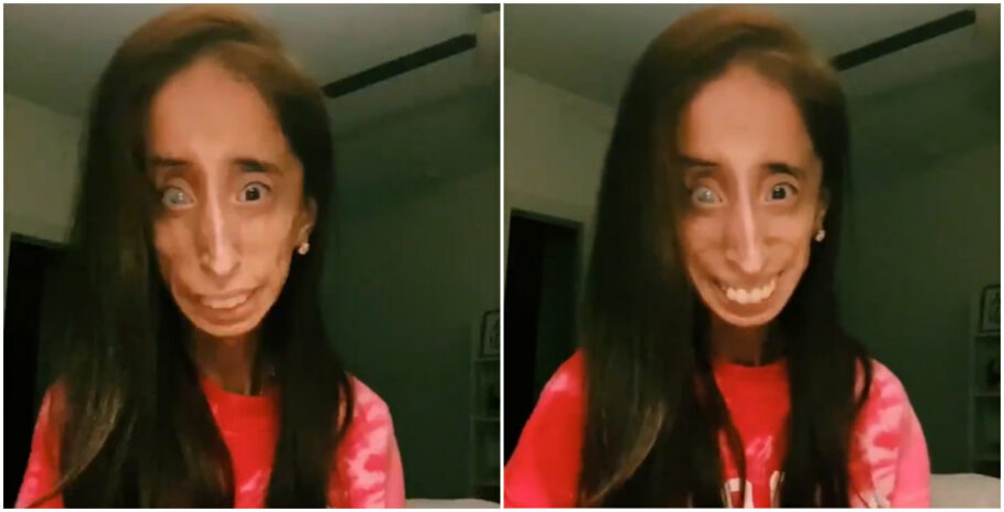 Autora Motivacional Lizzie Velasquez é Vítima De Bullying No Tiktok 