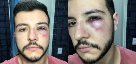Ex-jornalista da Globo, Matheus Ribeiro relata agressão em assalto