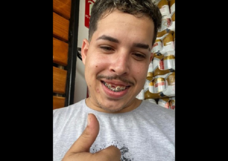 Jovem perde dente guardado na carteira e viraliza ao pedir ajuda na web