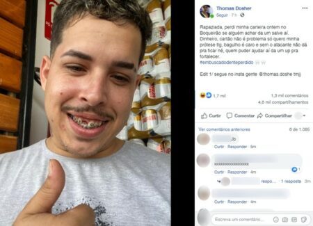 Jovem perde dente guardado na carteira e viraliza ao pedir ajuda na web