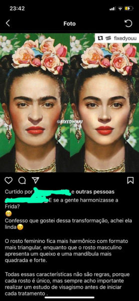 Dentista faz harmonização facial em foto de Frida Kahlo e revolta web