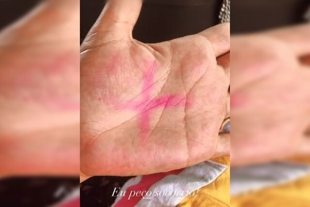 Mulher postou foto com X vermelho na mão para pedir socorro