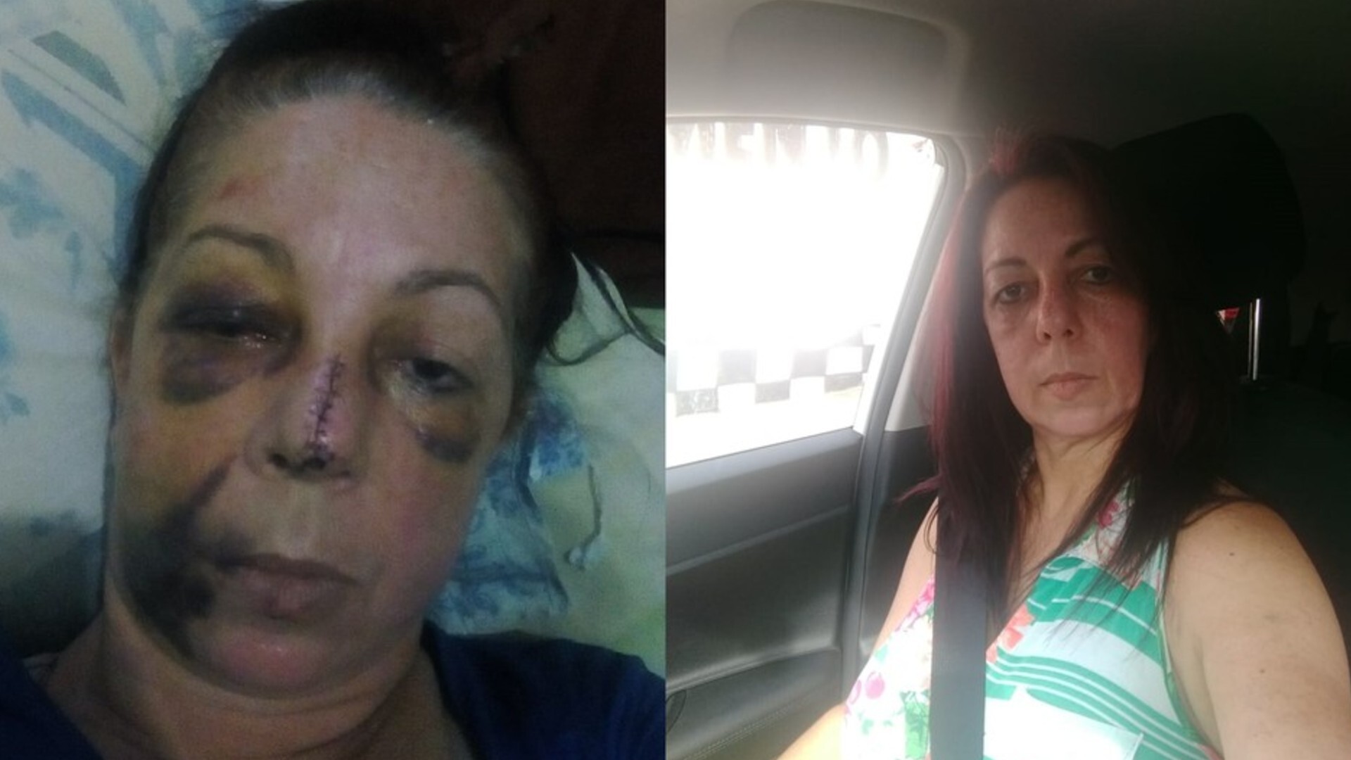 Liliane Borges Monteiro, de 49 anos, ficou com rosto machucado após abordagem policial em Bauru