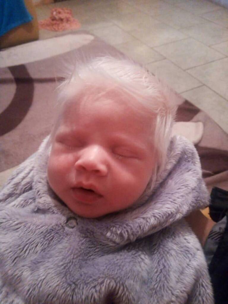 Bebê faz sucesso ao nascer com o cabelo todo branco no RS
