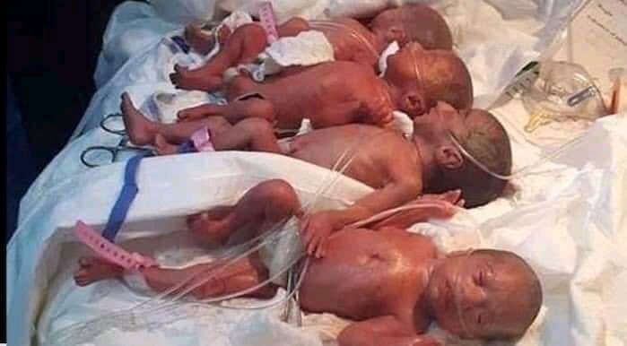 Gestante esperava 7 bebês, mas acabaram nascendo 9 em um caso raríssimo de nônuplos