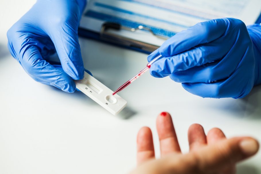 FDA pede para as pessoas não confiarem nos testes de anticorpos