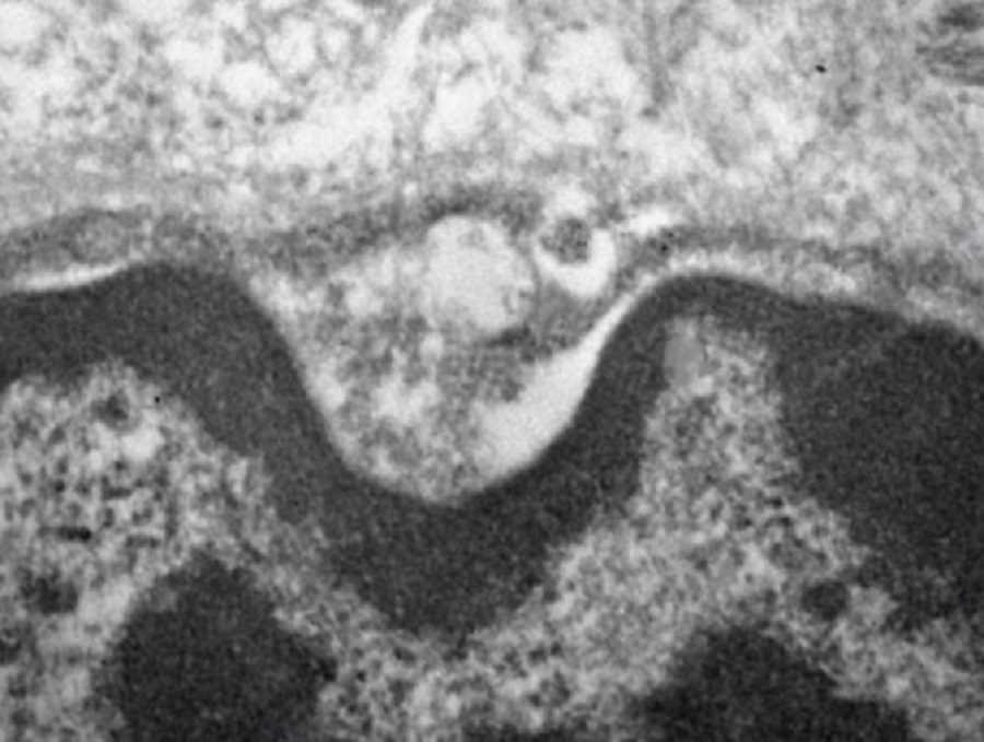 Estudo constata que o novo coronavírus  infecta e se replica em células das glândulas salivares
